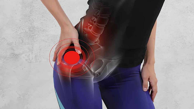 “Nên” hay “Không nên” thay khớp háng cho người cao tuổi Thay khớp háng cho người cao tuổi