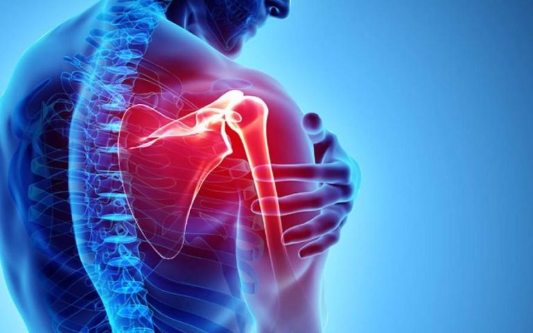 Điều trị đám rối thần kinh cách tay – GS.TS. Nguyễn Việt Tiến