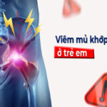 Viêm mủ khớp háng ở trẻ em: Bệnh lý nguy hiểm cần phát hiện sớm