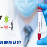 Virus Nipah là gì? Các biện pháp phòng ngừa lây nhiễm