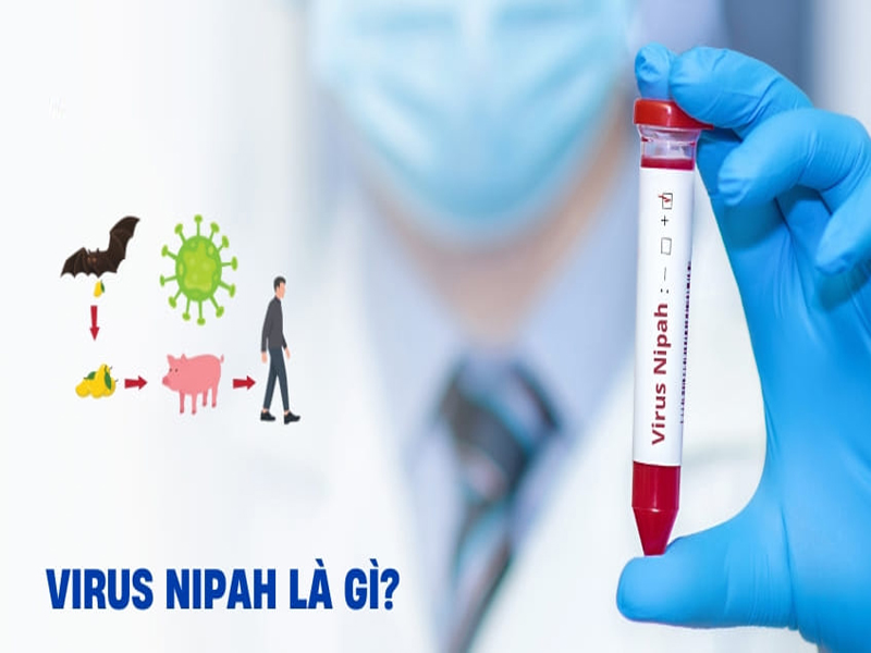 Virus Nipah là gì? Các biện pháp phòng ngừa lây nhiễm