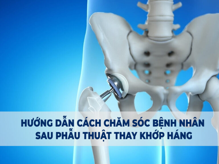 Hướng dẫn cách chăm sóc bệnh nhân sau phẫu thuật thay khớp háng