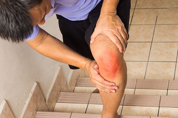 Tình trạng đau khớp gối khi lên xuống cầu thang có thể xuất phát từ nhiều nguyên nhân khác nhau