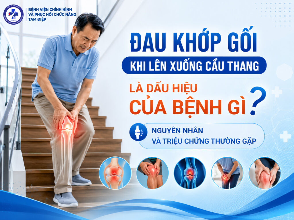 Đau khớp gối khi lên xuống cầu thang là dấu hiệu của bệnh gì? Nguyên nhân và triệu chứng thường gặp Đau khớp gối khi lên xuống cầu thang là dấu hiệu của bệnh gì? Nguyên nhân và triệu chứng thường gặp