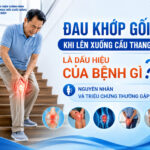 Đau khớp gối khi lên xuống cầu thang là dấu hiệu của bệnh gì? Nguyên nhân và triệu chứng thường gặp