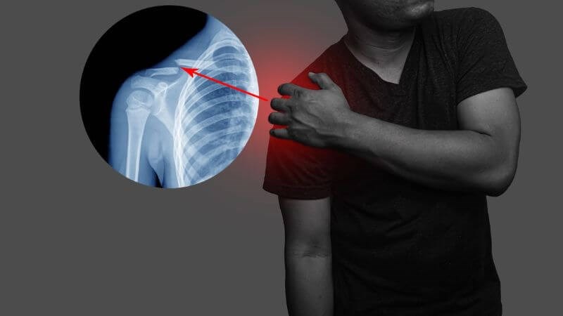 Thời gian hồi phục phụ thuộc vào tuổi tác, mức độ tổn thương và phương pháp điều trị